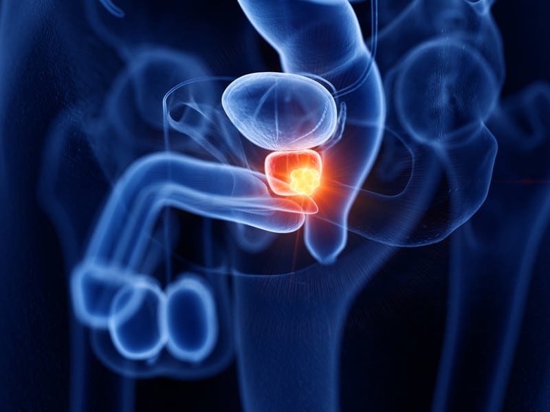 Prostata Bild AdobeStock Urheber SciePro