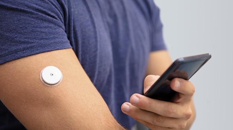 Man Testing Glucose Level With Continuous Glucose Monitor On Mobile Phone