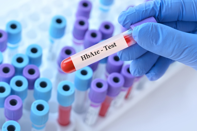 Bluttest im Labor